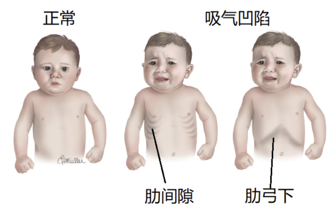 df02b93b90a9fb81e9fe094eb5b774d9.png df02b93b90a9fb81e9fe094eb5b774d9.png